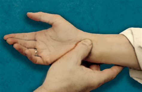 median nerve compression test darken test|tinel's test and phalen's.